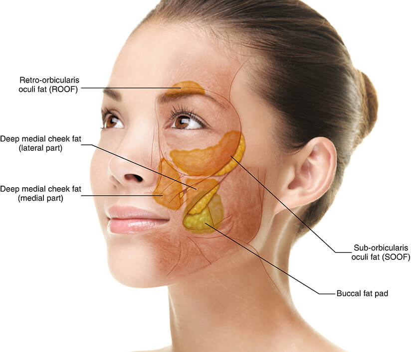 buccal-fat-everything-you-should-know-about-this-procedure